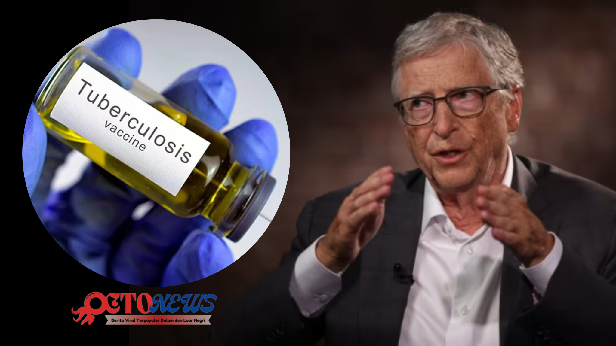 Indonesia akan uji klinis Vaksin TBC M72/AS01E Bill Gates